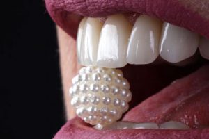 Estética Dental