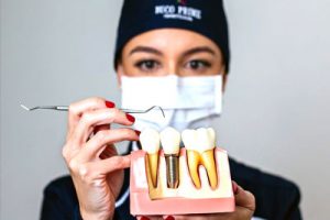 Implantes Dentais