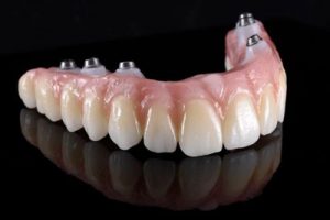 Protocolo sobre implantes